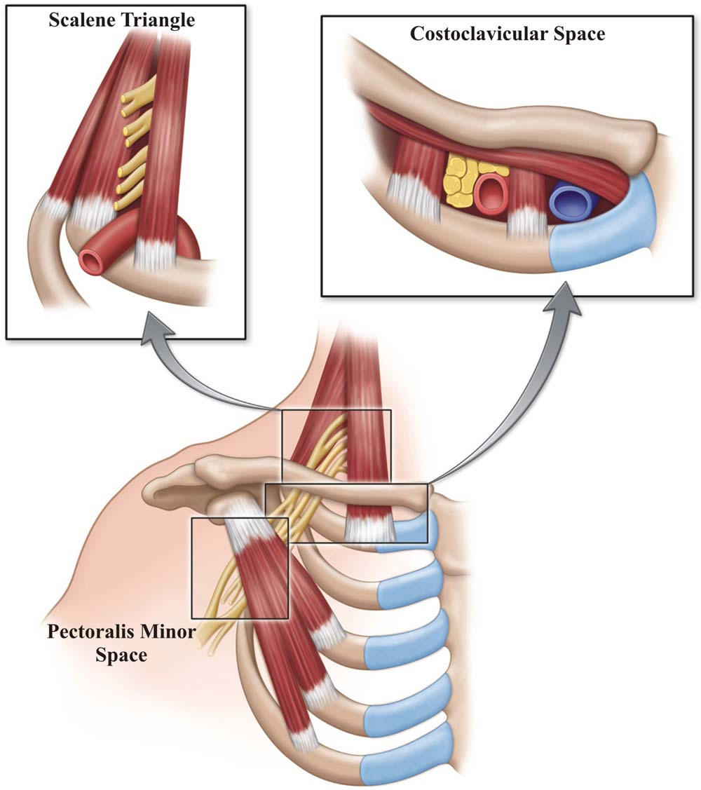 Onder de clavicula zitten veel zenuwen en bloedvaten. By Z. Klaassen et al. In Clinical Anatomy, 2013 May 29.